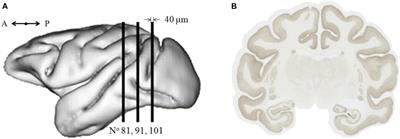 Automated Individualization of Size-Varying and Touching Neurons in Macaque Cerebral Microscopic Images